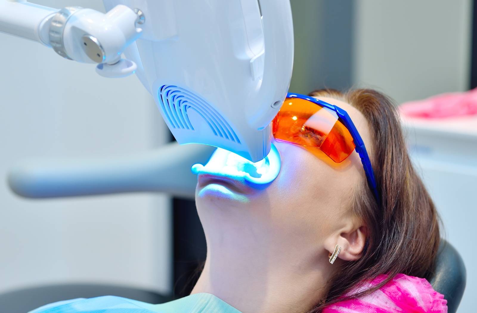 Laser Whitening for Teeth