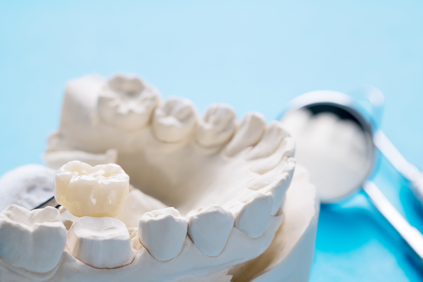 Understanding Porcelain Crowns and Their Benefits